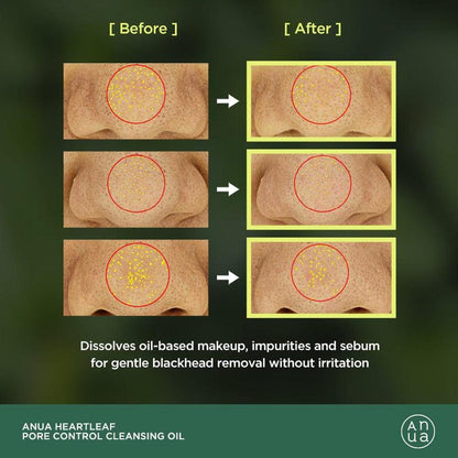 [Anua] Heartleaf Pore Control Cleansing Oil 200ml